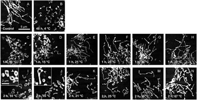Recovery from cold-induced mitochondrial fission in endothelial cells requires reconditioning temperatures of ≥ 25◦C